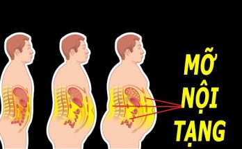 Mỡ nội tạng là phần mỡ thừa được tích tụ ở những nội tạng quan trọng của cơ thể như tim, gan, tuyến tụy và ruột. Chất béo có mặt ở khắp cơ thể bạn dưới dạng mô mỡ dưới da, mỡ nội tạng, mỡ tủy, mỡ trong hệ thống cơ và mỡ mô vú… giúp cung cấp năng lượng, duy trì nhiệt độ, hỗ trợ hoạt động của tế bào, các cơ quan và quá trình trao đổi chất trong cơ thể. Tuy nhiên khi chất béo dư thừa có thể gây ra béo phì. Đặc biệt khi dư thừa mỡ nội tạng sẽ làm bụng nhô ra phía trước gọi là mỡ bụng, làm tăng nguy cơ mắc một số bệnh sau: